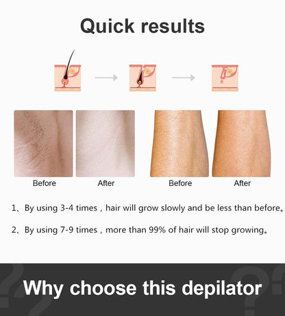 Ultrafast IPL Hair Removal Handset